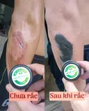 Bột Khô Sát Vết Thương – Giải Pháp Giúp Vết Thương Nhanh Lành, Nhanh Khô An Toàn - Bột Khô Y Sĩ - Ảnh 2